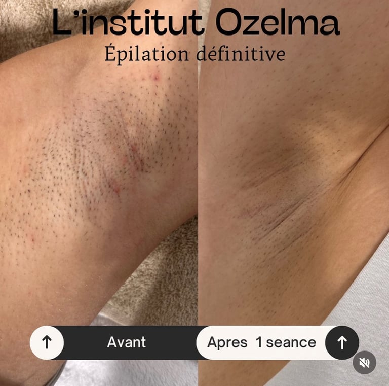 Détail de l’institut Ozelma à Oupeye