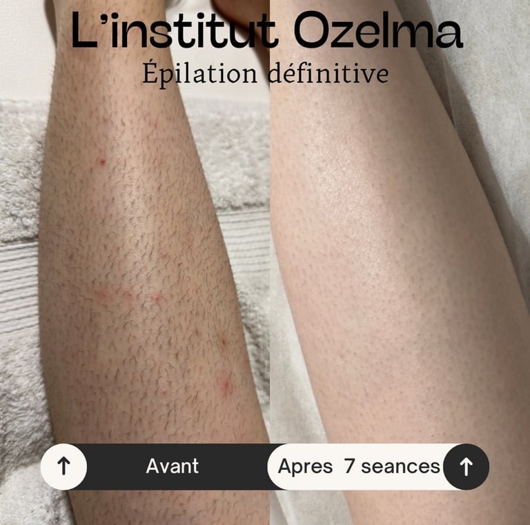 Ambiance de l’Institut Ozelma